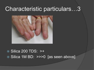 Characteristic particulars…3Silica 200 TDS:  >+
