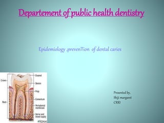 Departement of public health dentistry
Epidemiology ,prevenTion of dental caries
Presented by,
Shiji margaret
CRRI
 