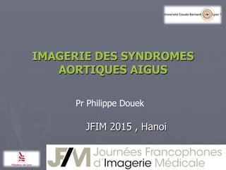 IMAGERIE DES SYNDROMES
AORTIQUES AIGUS
Pr Philippe Douek
JFIM 2015 , Hanoi
 