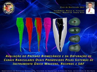 Tese de Doutorado 2012

                                                            Candidato: Marco A. Versiani
                                                        Orientador: Manoel D. Sousa Neto




   A VA L I A Ç ÃO D O P R E PA R O B I O M E C Â N I C O E D A O BT U R A Ç ÃO D E
  C A N A I S R A D I C U L A R E S O VA I S P R O M O V I D O S P E LO S S I S T E M A S D E
            I N S T R U M E N T O Ú N I C O W AV E O N E , R E C I P R O C E S A F

Departamento de Dentística Restauradora, Faculdade de Odontologia de Ribeirão Preto, Universidade de São Paulo
 