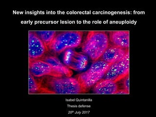 New insights into the colorectal carcinogenesis: from
early precursor lesion to the role of aneuploidy
Isabel Quintanilla
Thesis defense
20th July 2017
 