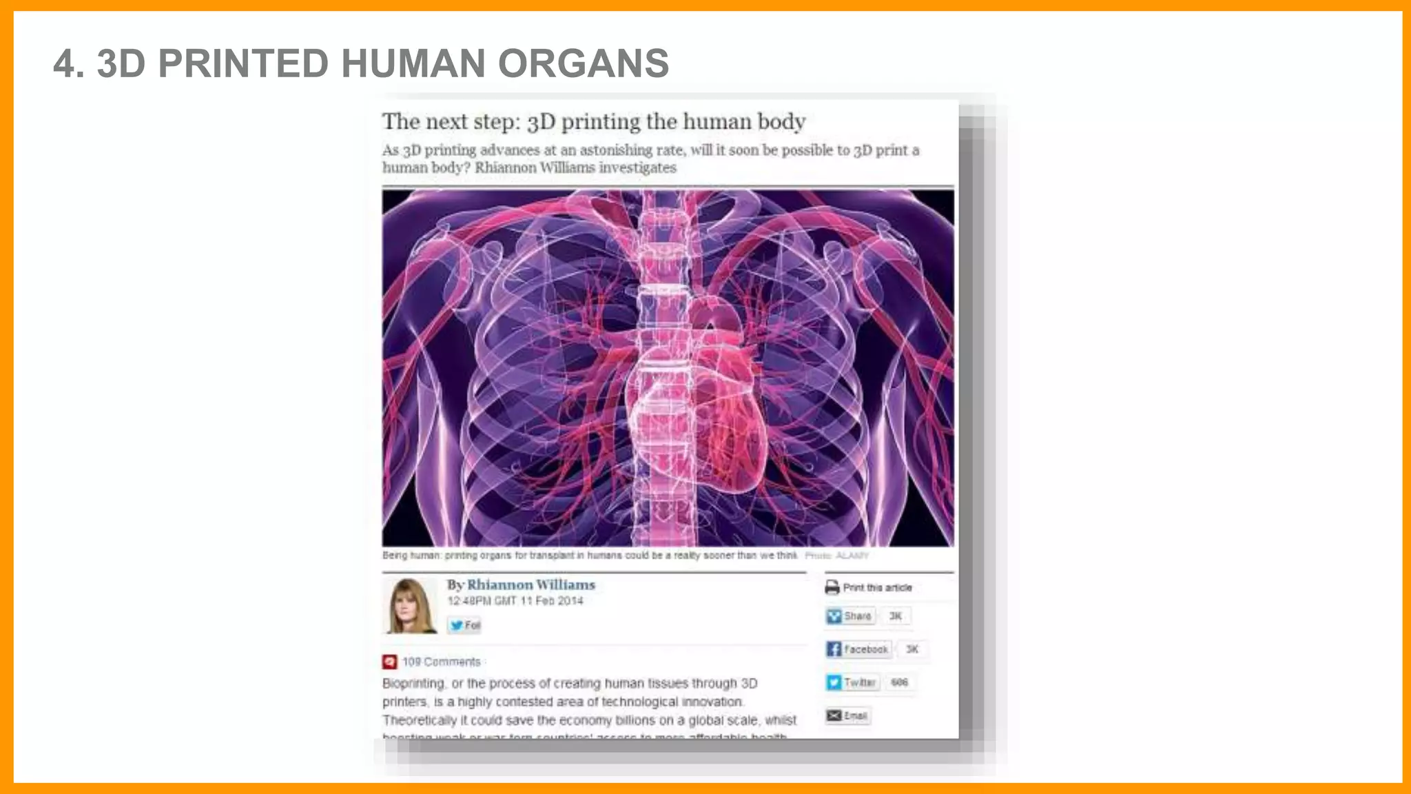 4. 3D PRINTED HUMAN ORGANS
 