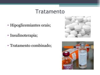 Tratamento
• Hipoglicemiantes orais;
• Insulinoterapia;
• Tratamento combinado;
 