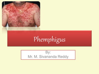 Phemphigus
By:
Mr. M. Sivananda Reddy
 