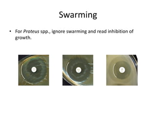 Phenotypic methods used in antimicrobial susceptibility testing