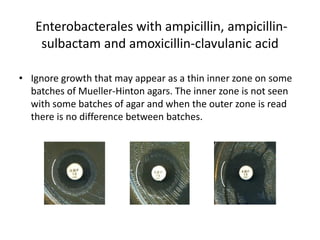 Phenotypic methods used in antimicrobial susceptibility testing