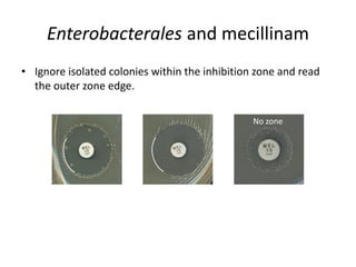 Phenotypic methods used in antimicrobial susceptibility testing