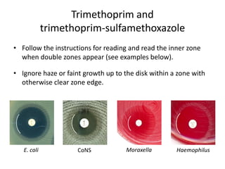Phenotypic methods used in antimicrobial susceptibility testing