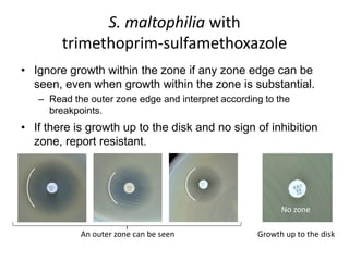 Phenotypic methods used in antimicrobial susceptibility testing