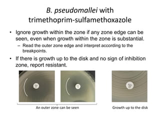 Phenotypic methods used in antimicrobial susceptibility testing