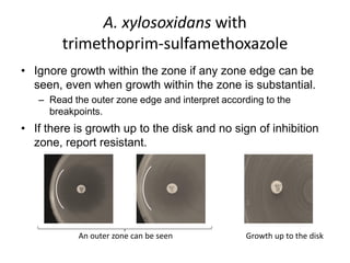 Phenotypic methods used in antimicrobial susceptibility testing