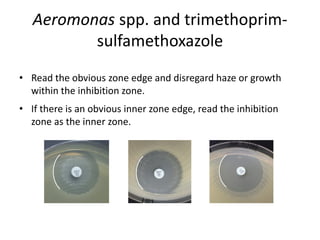 Phenotypic methods used in antimicrobial susceptibility testing