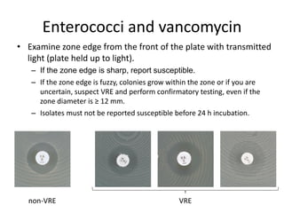 Phenotypic methods used in antimicrobial susceptibility testing