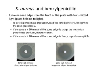 Phenotypic methods used in antimicrobial susceptibility testing
