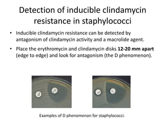 Phenotypic methods used in antimicrobial susceptibility testing