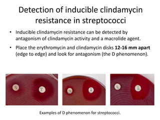 Phenotypic methods used in antimicrobial susceptibility testing