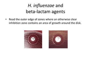 Phenotypic methods used in antimicrobial susceptibility testing