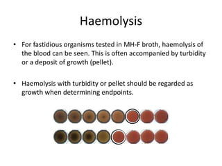 Phenotypic methods used in antimicrobial susceptibility testing