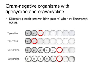 Phenotypic methods used in antimicrobial susceptibility testing