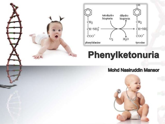 Phenylketonuria Symptoms - 638x479 - jpeg Phenylketonuria Symptoms