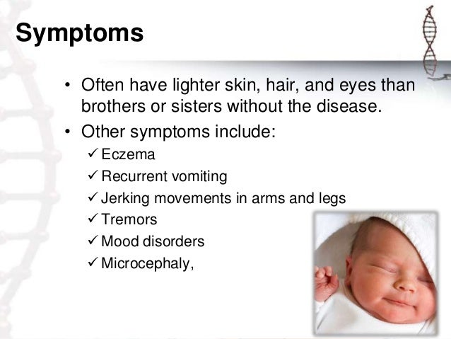 Phenylketonuria Symptoms - 638x479 - jpeg Phenylketonuria Symptoms