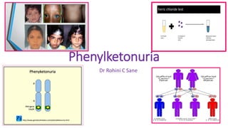 Phenylketonuria
Dr Rohini C Sane
 