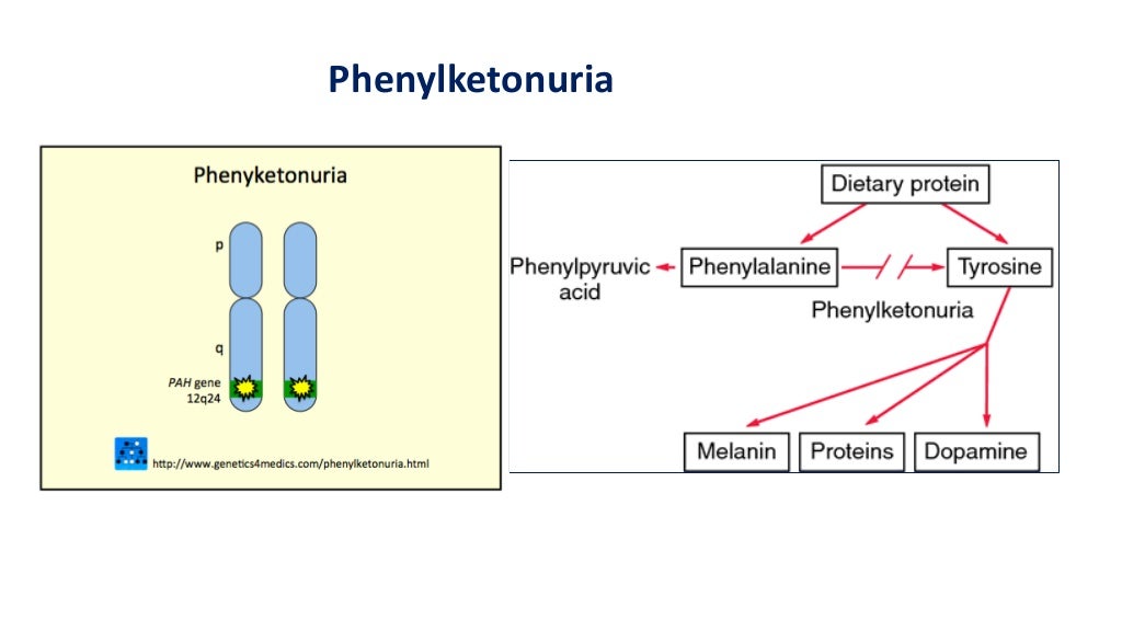 Phenylketonuria