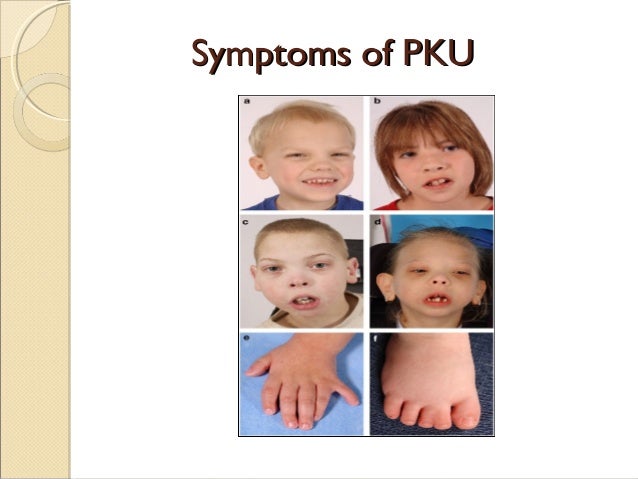 Phenylketonuria (PKU)
Phenylketonuria Disease