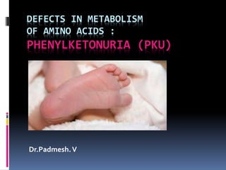 DEFECTS IN METABOLISM
OF AMINO ACIDS :
PHENYLKETONURIA (PKU)
Dr.Padmesh.V
 