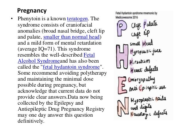 Phenytoin Phenytoin
