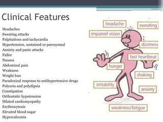 Clinical Features
Headaches
Sweating attacks
Palpitations and tachycardia
Hypertension, sustained or paroxysmal
Anxiety and panic attacks
Pallor
Nausea
Abdominal pain
Weakness
Weight loss
Paradoxical response to antihypertensive drugs
Polyuria and polydipsia
Constipation
Orthostatic hypotension
Dilated cardiomyopathy
Erythrocytosis
Elevated blood sugar
Hypercalcemia
 