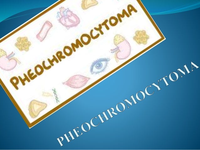 Pheochromocytoma Pheochromocytoma