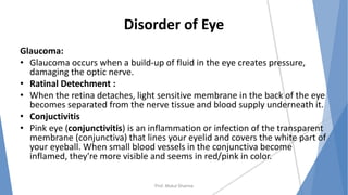 Disorder of Eye
Glaucoma:
• Glaucoma occurs when a build-up of fluid in the eye creates pressure,
damaging the optic nerve.
• Ratinal Detechment :
• When the retina detaches, light sensitive membrane in the back of the eye
becomes separated from the nerve tissue and blood supply underneath it.
• Conjuctivitis
• Pink eye (conjunctivitis) is an inflammation or infection of the transparent
membrane (conjunctiva) that lines your eyelid and covers the white part of
your eyeball. When small blood vessels in the conjunctiva become
inflamed, they're more visible and seems in red/pink in color.
Prof. Mukul Sharma
 