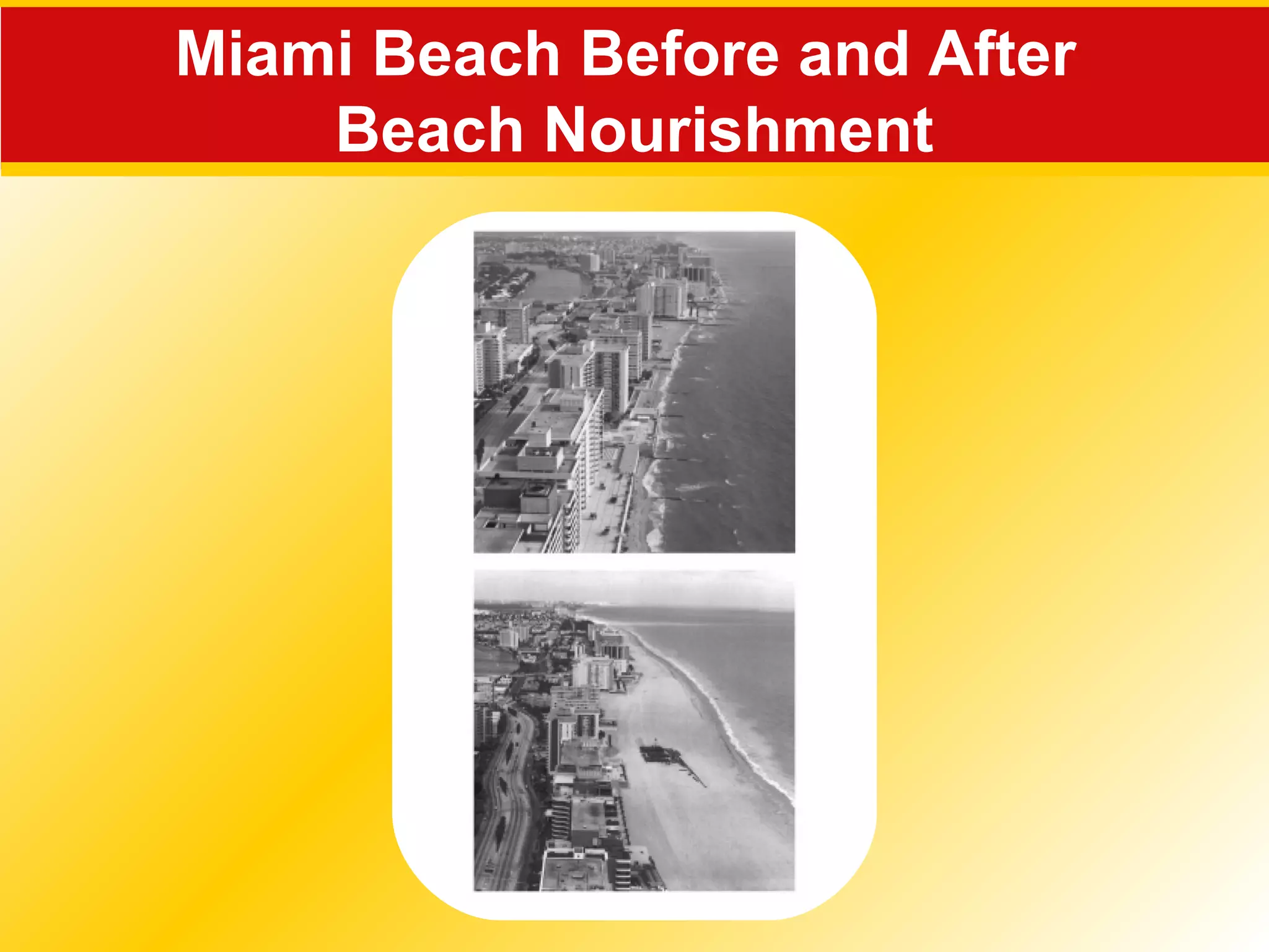 Miami Beach Before and After
Beach Nourishment
 