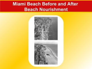 Miami Beach Before and After
Beach Nourishment
 