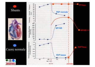IP fissa

   Shunts       PAP normale




                QP=QS
                                            QP/QS <1




                                          RVP fisse
Cuore normale
                RVP basse



                            arteriolite
 