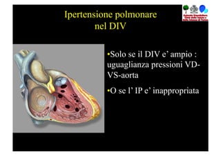 Ipertensione polmonare
        nel DIV

          • Solo se il DIV e’ ampio :
          uguaglianza pressioni VD-
          VS-aorta
          • O se l’ IP e’ inappropriata
 