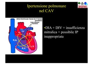 Ipertensione polmonare
       nel CAV



         • DIA + DIV + insufficienza
         mitralica + possibile IP
         inappropriata
 