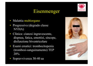 Eisenmenger
•  Malattia multiorgano
•  Progressiva (degrado classe
   NYHA)
•  Clinica: cianosi ingravescente,
   dispnea, fatica, emottisi, sincope,
   disfunzione biventricolare
•  Esami ematici: trombocitopenia
   (trombosi-sanguinamento) TEP
   20%
•  Sopravvivenza 30-40 aa
 