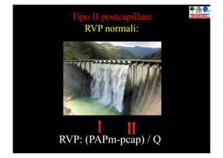 Tipo II postcapillare
     RVP normali:




RVP: (PAPm-pcap) / Q
 