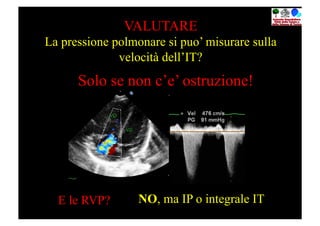 VALUTARE
La pressione polmonare si puo’ misurare sulla
              velocità dell’IT?
      Solo se non c’e’ ostruzione!




  E le RVP?       NO, ma IP o integrale IT
 