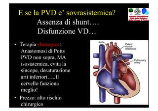 E se la PVD e’ sovrasistemica?
       Assenza di shunt….
        Disfunzione VD…
•  Terapia chirurgica:
   Anastomosi di Potts
   PVD non sopra, MA
   isosistemica, evita la
   sincope, desaturazione
   arti inferiori…..Il
   cervello funziona
   meglio!
•  Prezzo: alto rischio
   chirurgico
 