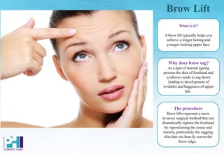 Brow Lift
Why does brow sag?
As a part of normal ageing
process the skin of forehead and
eyebrows tends to sag down
leading to development of
wrinkles and bagginess of upper
lids.
What is it?
A brow lift typically helps you
achieve a longer lasting and
younger looking upper face.
The procedure
Brow lifts represent a more
invasive surgical method that can
dramatically tighten the forehead
by repositioning the tissue and
muscle, particularly the sagging
skin that sits heavily across the
brow ridge.
 