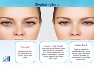 Blepharoplasty
What is it?
Blepharoplasty refers
to a reshaping surgery
of upper and/or lower
eyelid.
Healing Time?
This is an out patient
procedure typically with a
week to a week and a half
recovery dependent on
how much the individual’s
tissues bruise.
Why do eyelids droop?
As you age, excess fat may gather
above and below your eyelids,
since the muscles around it get
weaker, causing saggy eyebrows,
droopy upper lids and baggy
under eyes.
 