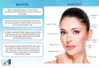 BOTOX
Botox works by preventing your muscle from
contracting, which allows the skin to relax and become
more supple.
The actual treatment is virtually painless and involves
injecting tiny quantities of Botox directly into the areas
of your face that require a lift.
We use Original Cosmetic Botox™ unlike other clinics
which often use cheaper, unreliable versions of the
same. They may cost lesser, but are untested and can
have side effects or results that don’t last and hence
require multiple sittings.
Useful For?
Our highly experienced Plastic Surgeons perform Botox
with precision and care. The results of which can be
seen in around two weeks after treatment, and they
will last around 6-8 months.
Eyebrow Lift
Crow’s Feet
Square Jaw
Dimpled Chin
Neck Lines
Forehead
Lines
Frown
Lines
Nasal
Lines
Smile
Lift
 