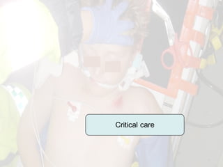 Critical care
 