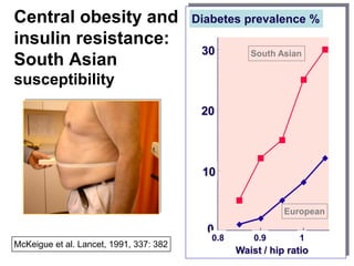 Central obesity and
insulin resistance:
South Asian
susceptibility
McKeigue et al. Lancet, 1991, 337: 382
0.8 0.9 1
0
10
20
30
40
50
2h insulin (mU/l)
Waist / hip ratio
0.8 0.9 1
0
10
20
30
Diabetes prevalence (%)
Waist / hip ratio
6 7
ose
opean
From Mckeigue et al. Lancet, 1991, 337: 382
South Asian
European
Diabetes prevalence %
Waist / hip ratio
30
20
10
0
0.8 0.9 1
 