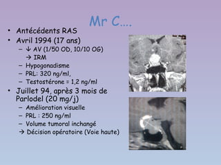 Mr C….
• Antécédents RAS
• Avril 1994 (17 ans)
   –  AV (1/50 OD, 10/10 OG)
      IRM
   – Hypogonadisme
   – PRL: 320 ng/ml,
   – Testostérone = 1,2 ng/ml
• Juillet 94, après 3 mois de
  Parlodel (20 mg/j)
   – Amélioration visuelle
   – PRL : 250 ng/ml
   – Volume tumoral inchangé
    Décision opératoire (Voie haute)
 