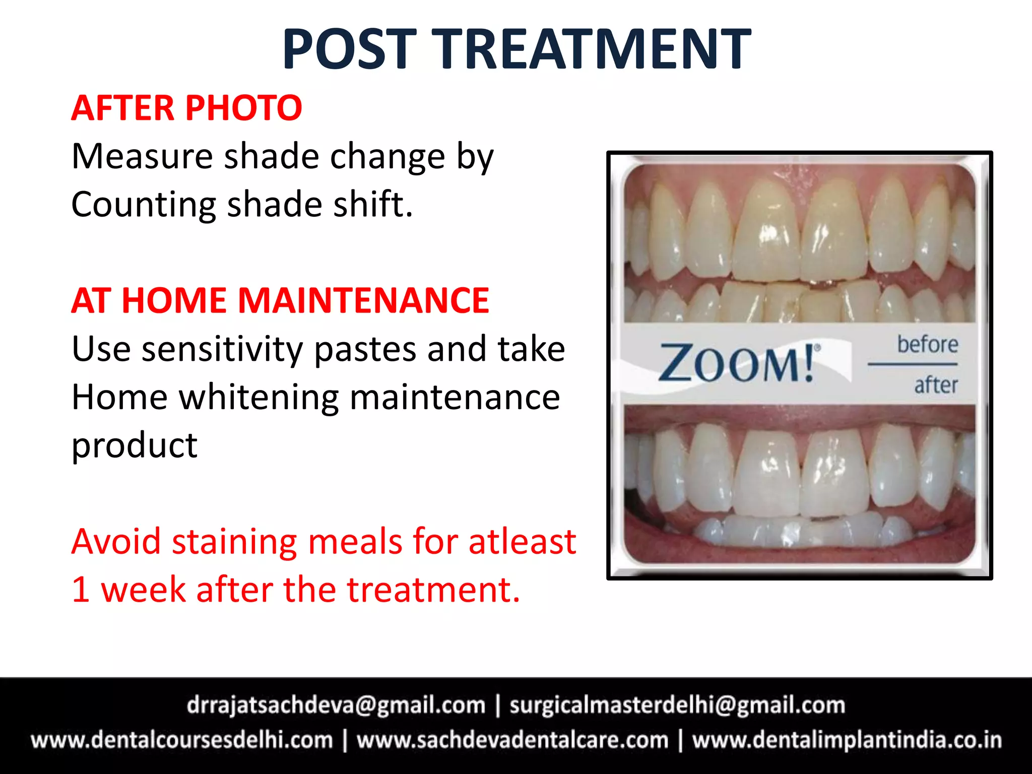 POST TREATMENT
AFTER PHOTO
Measure shade change by
Counting shade shift.
AT HOME MAINTENANCE
Use sensitivity pastes and take
Home whitening maintenance
product
Avoid staining meals for atleast
1 week after the treatment.
 