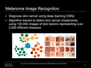 26 Jan 2019
Deep Learning
Melanoma Image Recognition
71
Source: https://www.techemergence.com/machine-learning-medical-dia...